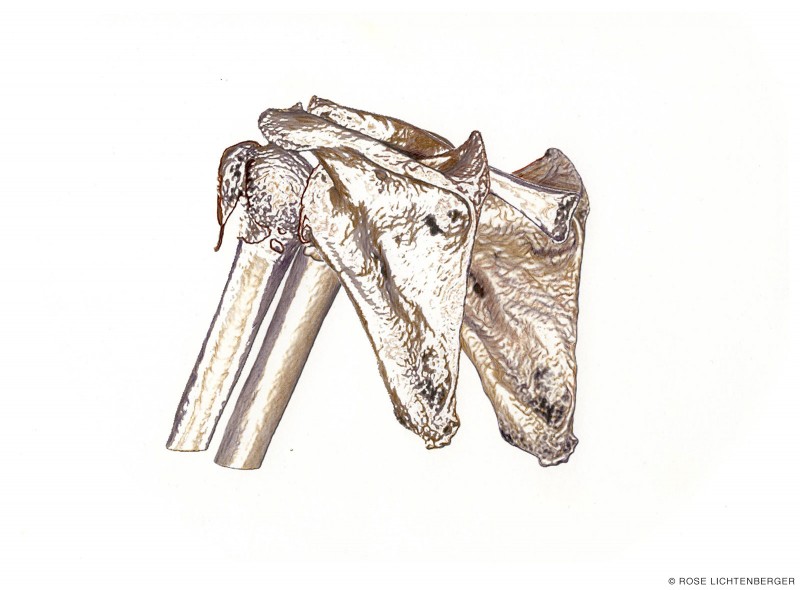 Abbildung: Game of Broken Bones