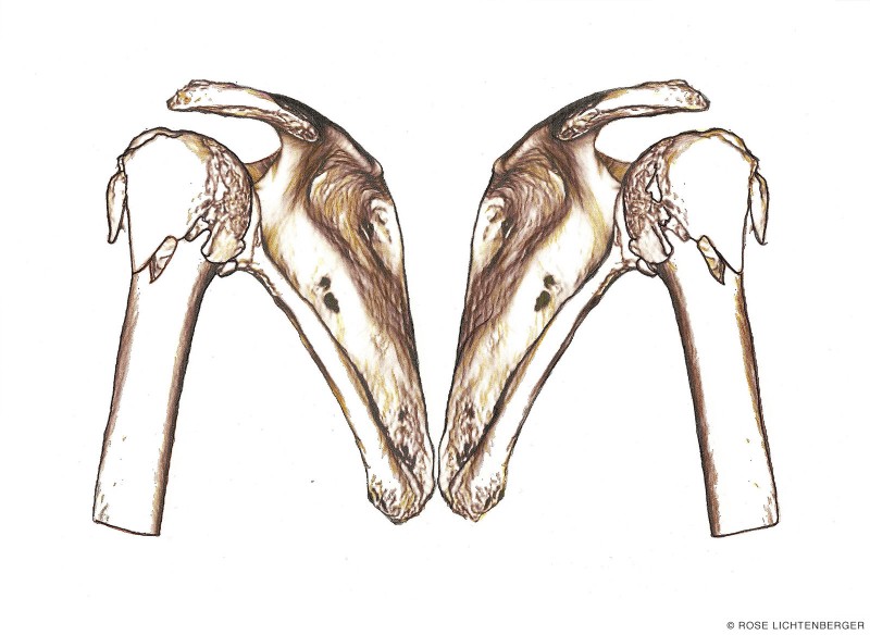 Abbildung: Game of Broken Bones